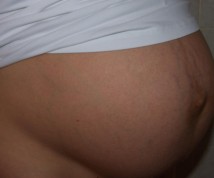 W ciąży - ogłoszenie towarzyskie użytkownika brzusio